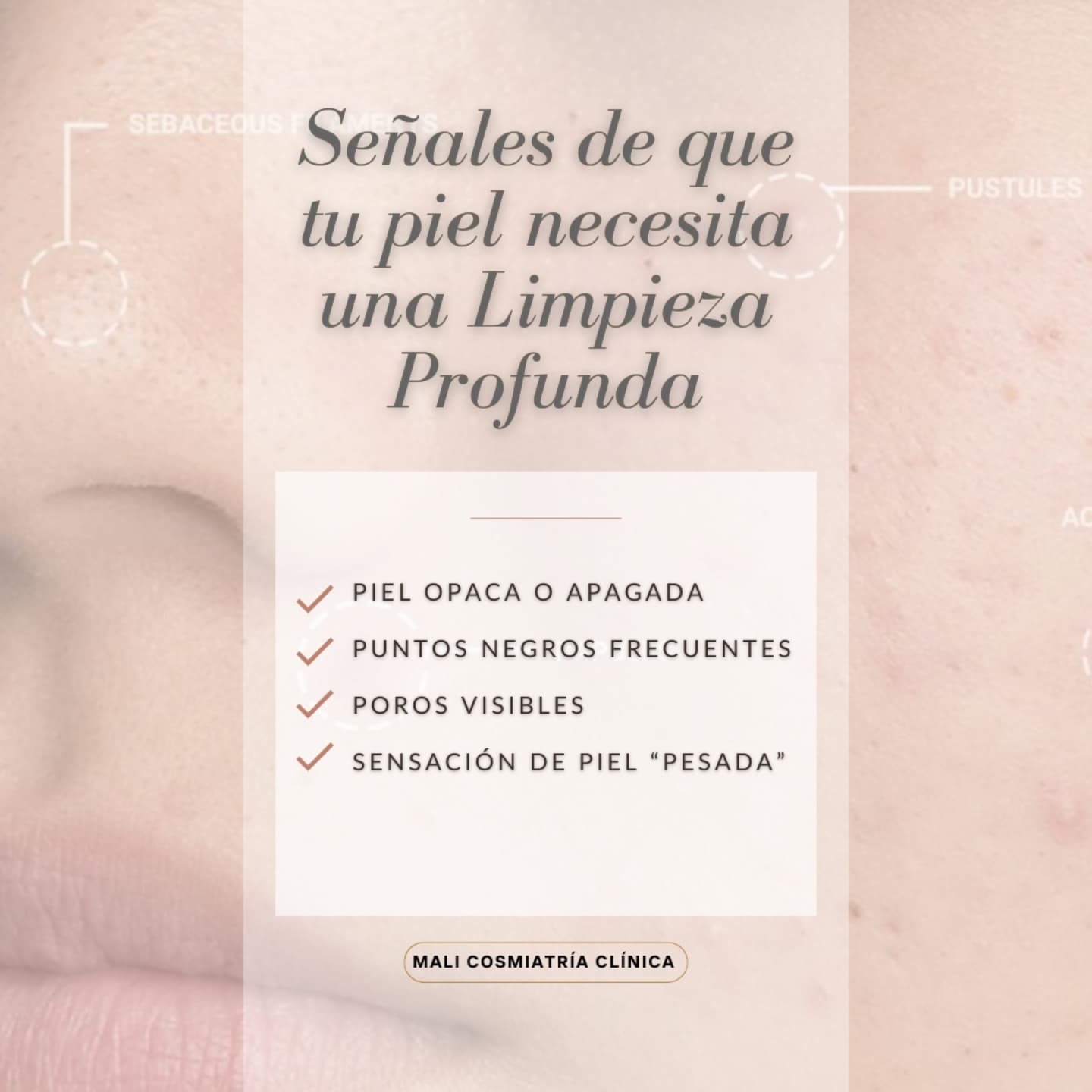 Señales de limpieza profunda